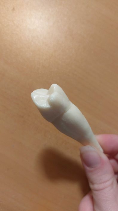 Сапунен зъб 4ти зъб