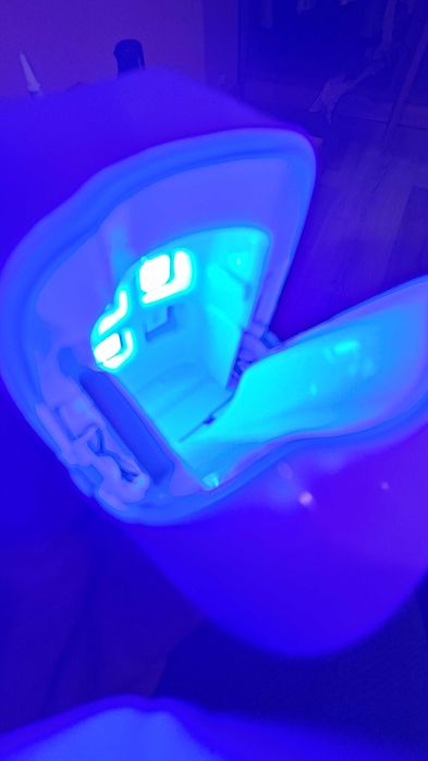 UV лампа за премахване на гъбички по ноктите