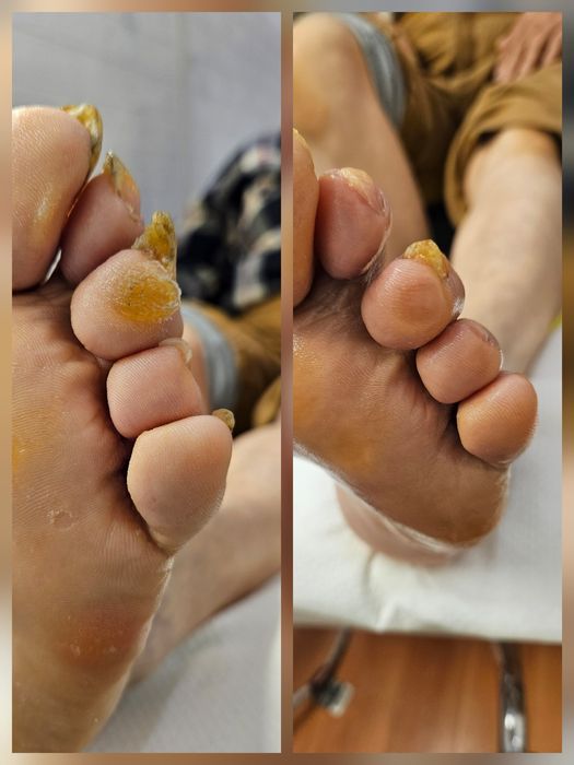 Pedichiură clasică Oradea