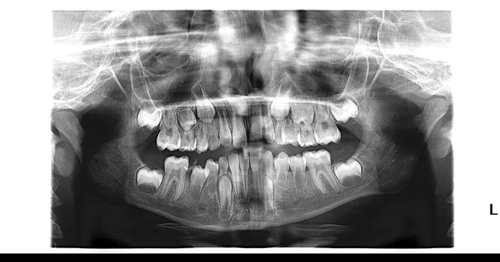 Ortopantomograf Soredex Cranex Novus aparat radiologie dentara
