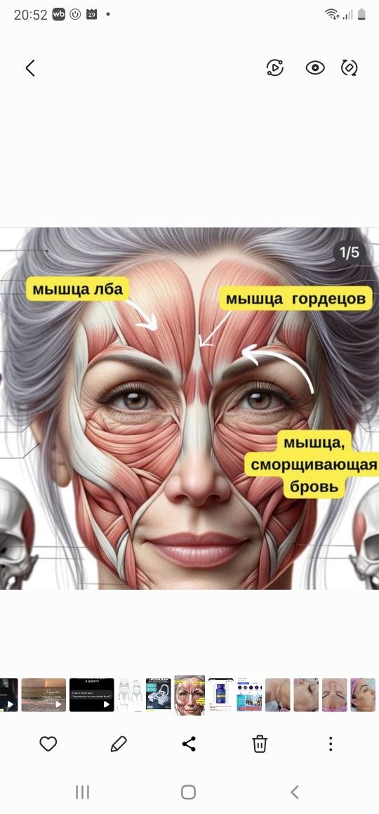 Ботокс фулл фейз, тепа  учли кисм, гипергидроз, губы, филлеры