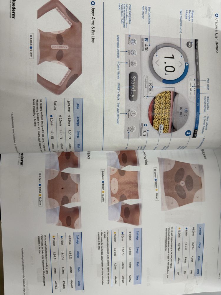 ULFIT - remodelare corporala - face lifting & body contouring system