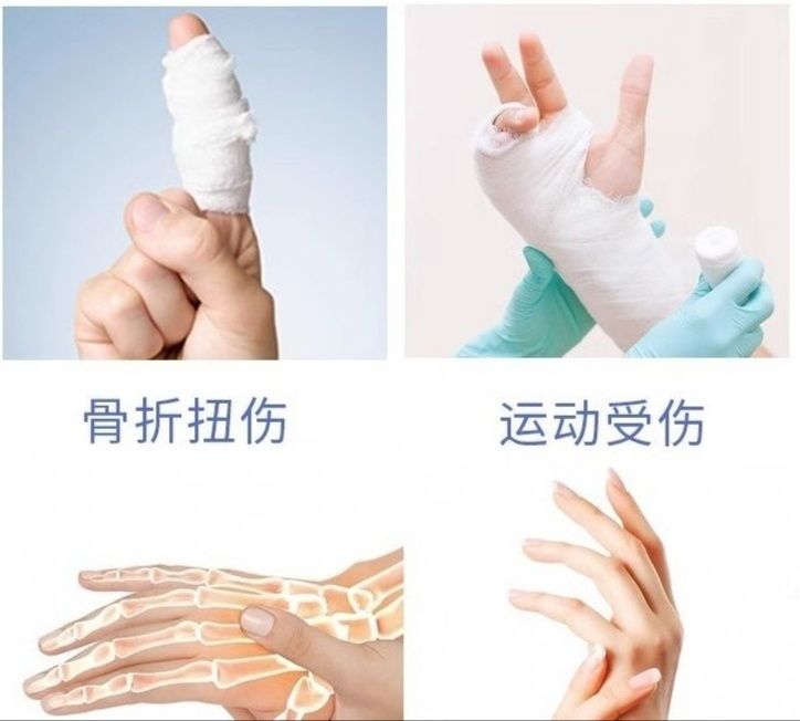 Ортез фиксатор для пальцев рук вместо гипса бандаж для всех пальцев