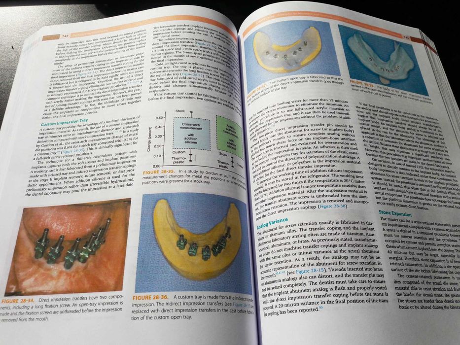 Dental Implant Prosthetics: Carl Misch - (Implantologie protetică)