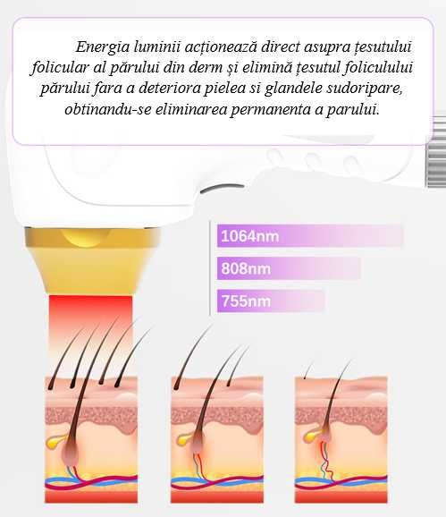 Inchiriere aparat epilare definitiva laser dioda