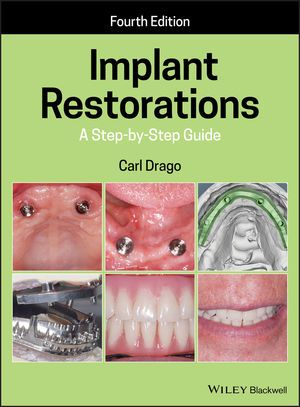Implant Restorations: A Step-by-Step Guide,4th Edition - Carl J. Drago