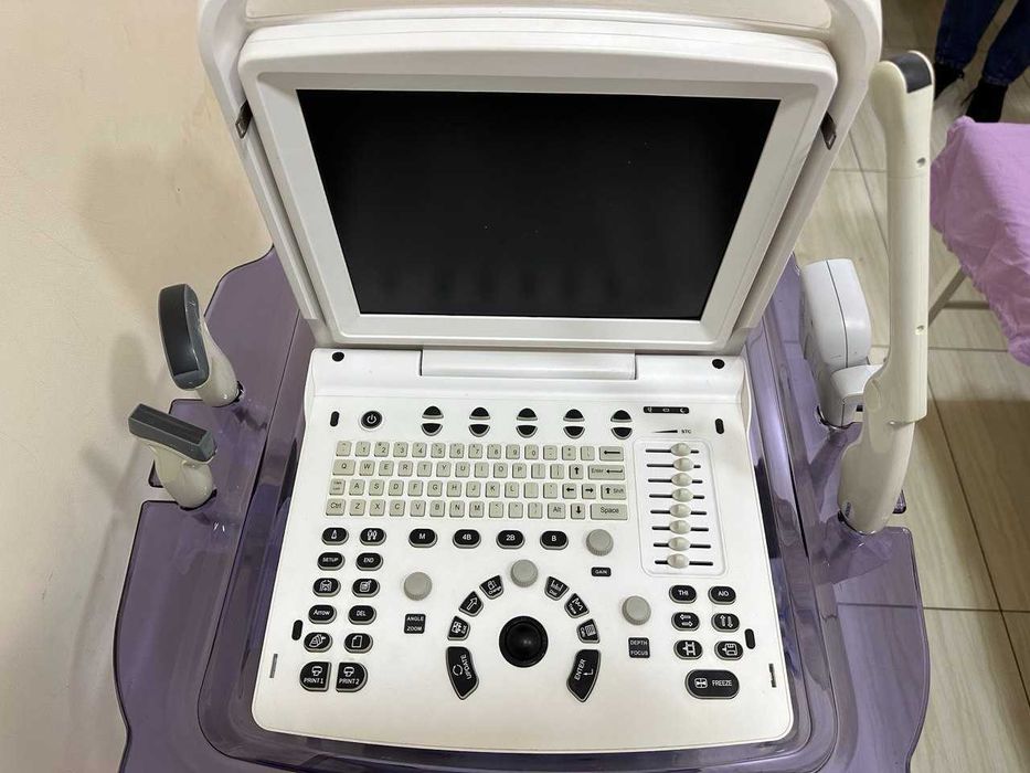 УЗИ аппарат портативный CHISON