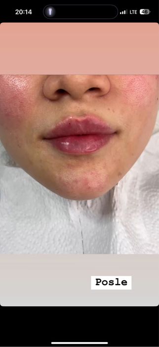 Косметолог Kosmetolog Kasmetologik muolajalar