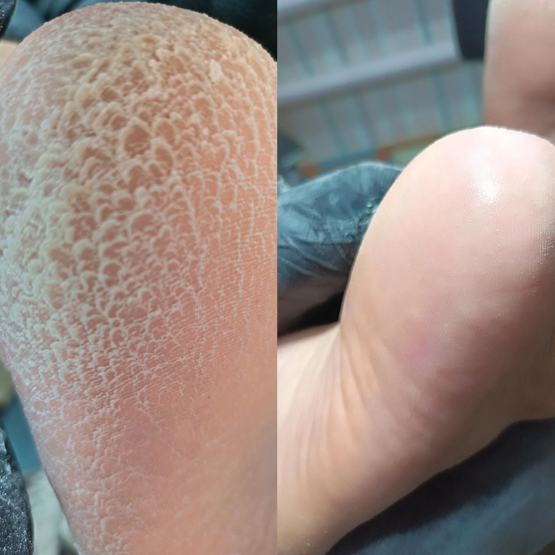 Педикюр мужской не дорого