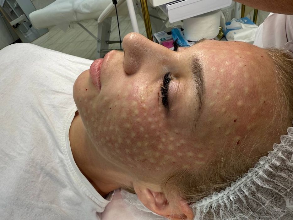 Чистка,  пилинг, мезотерапия, ботокс