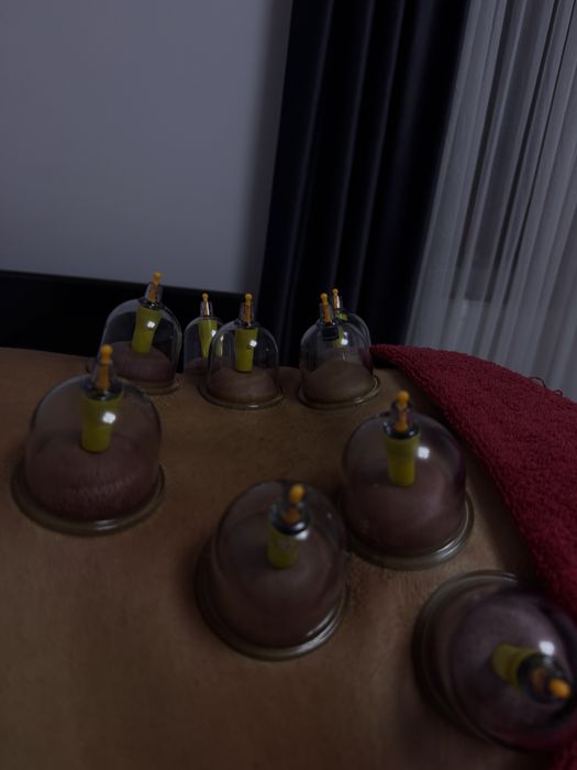 Masaj terapeutic, de relaxare, cupping ventuze