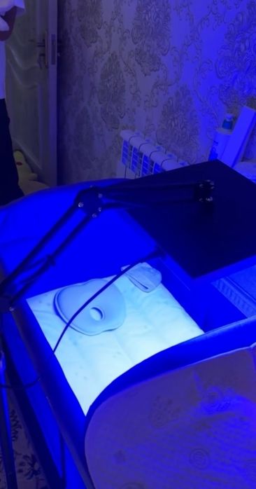 Fotolampa chaqaloqlardagi sariqlikni yo'qotish uchun fototetapiya