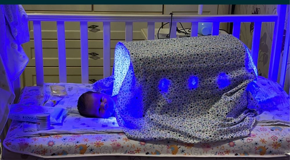 999тг/+Доставка/фотолампа от желтухи/желтушки/лампа/аренда/прокат