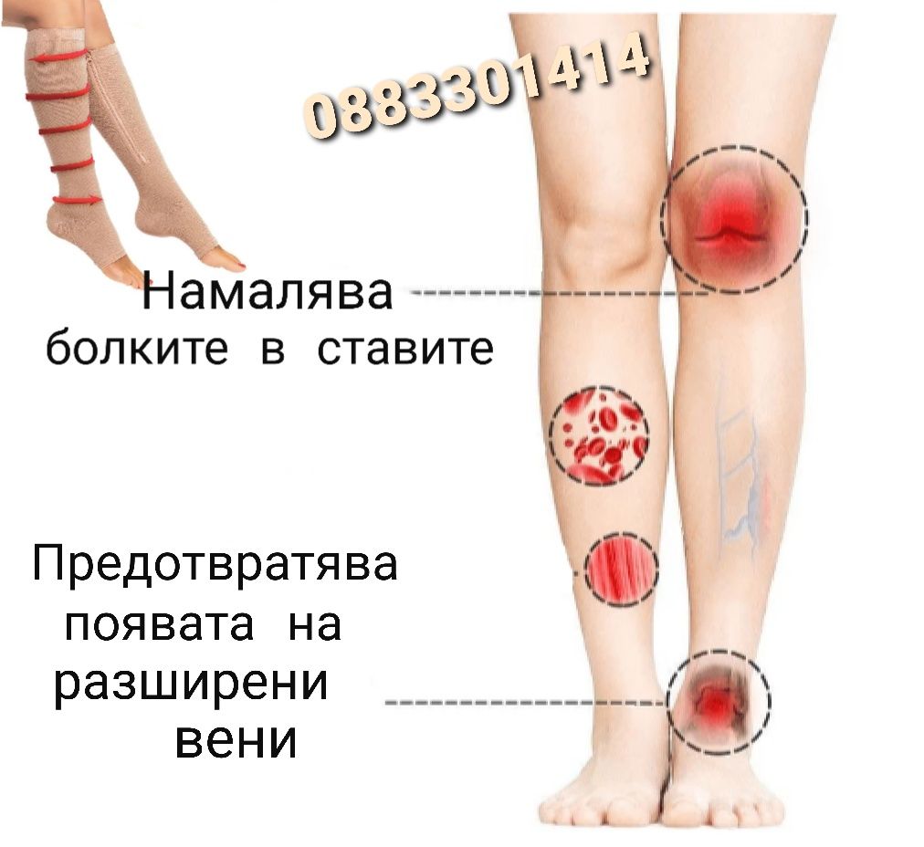 Компресивни чорапи против разширени вени