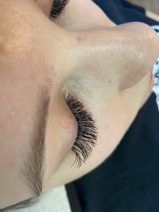 Extensii de gene Ploiesti