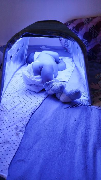 Продам лампу от желтушки