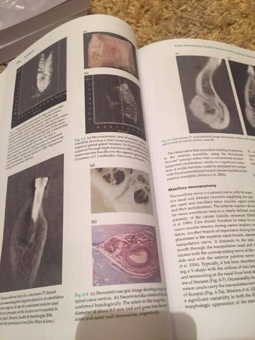 Clinical Periodontology and Implant Dentistry- LINDHE 7th Edition 2022