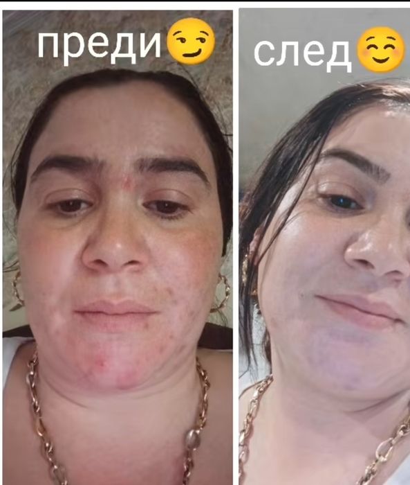 ПРОМОЦИЯ Серум за лице