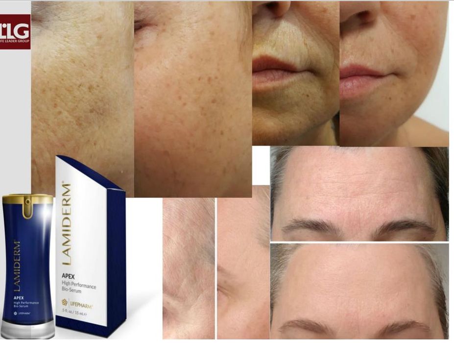 Lamiderm serum Apex – serul de piele