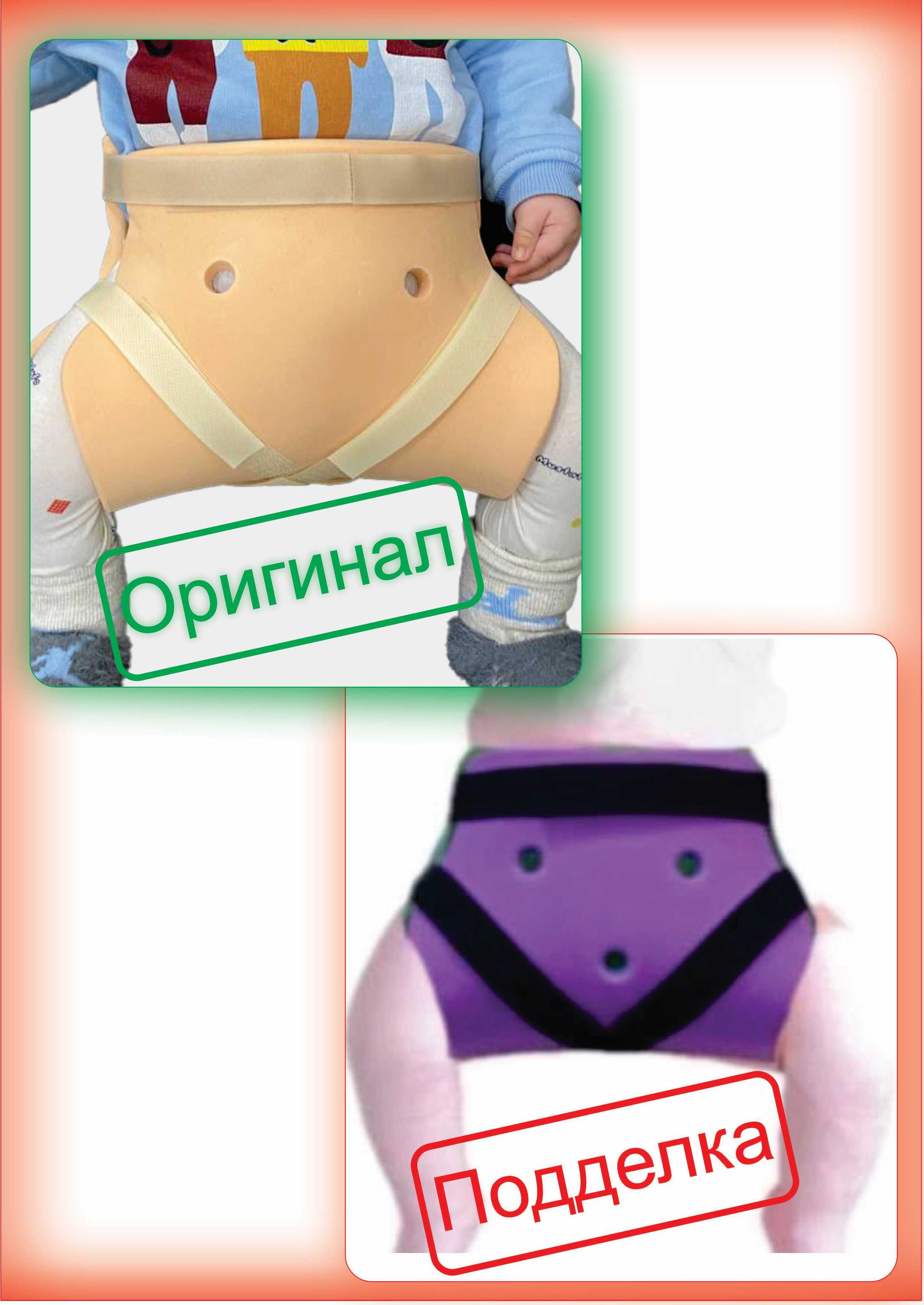 Шина фрейка при дисплазии (ОРИГИНАЛ)