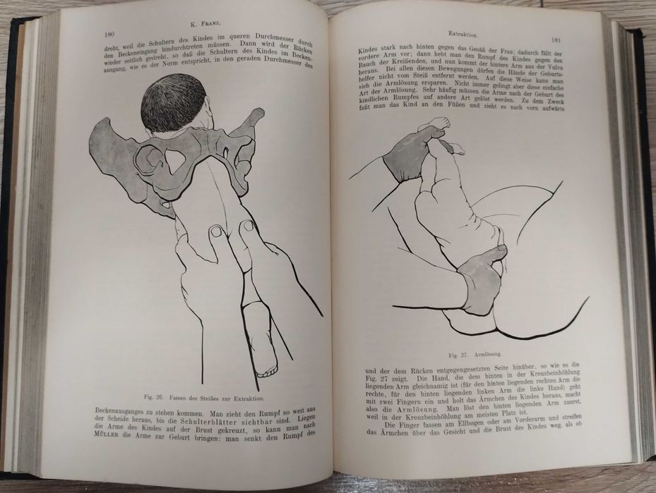 Carte medicina foarte veche 1912, in limba germana