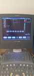 Ecograf Doppler color Siemens acuson