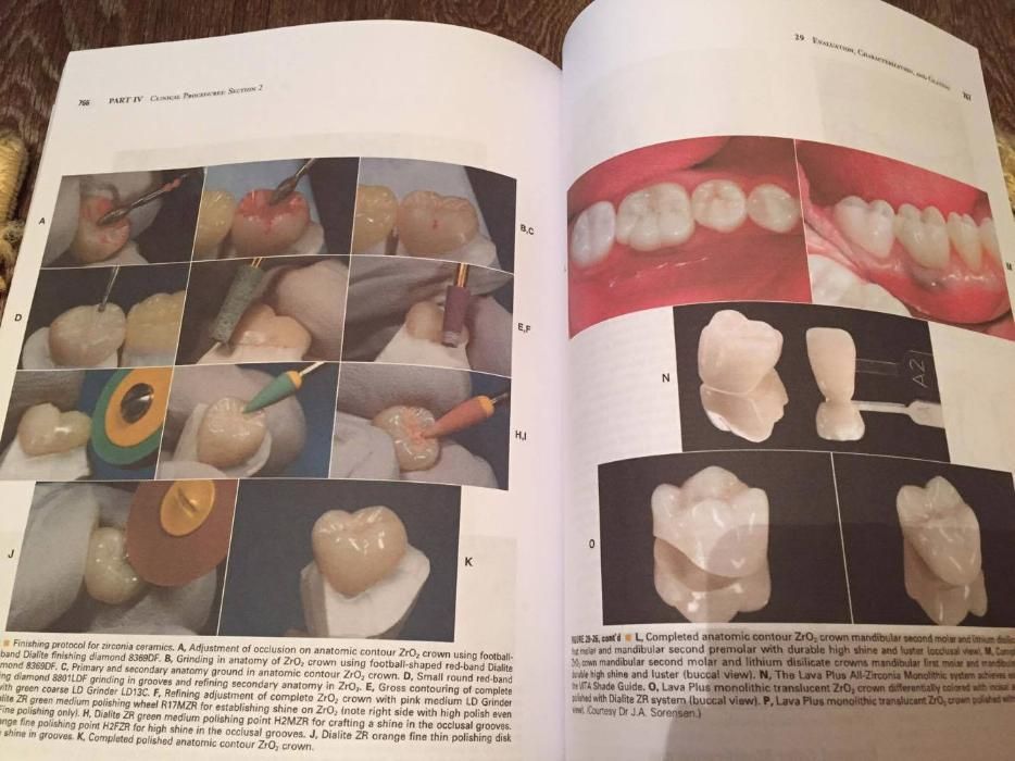 Contemporary Fixed Prosthodontics 5nd Edition 2015 Rosenstiel