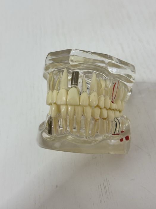 Учебная модель челюсти с имплантами