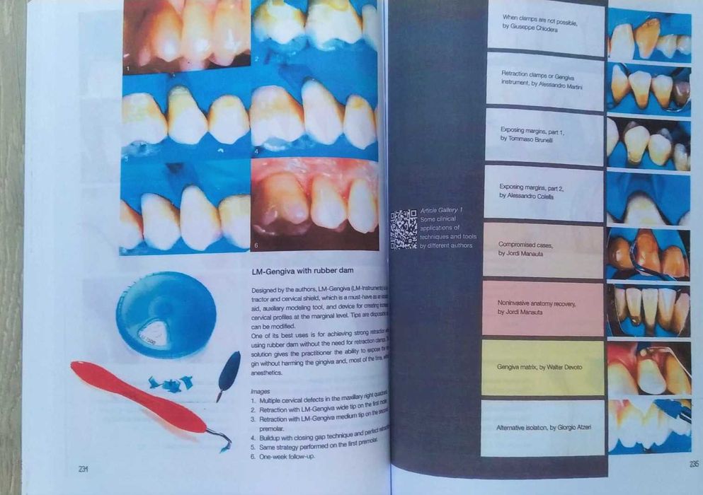 Layers 2 Direct Composites: The Styleitaliano Clinical Secrets - 2022