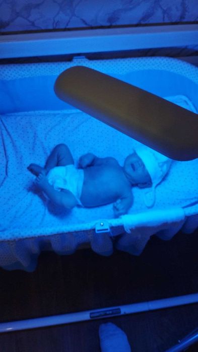 фототерапия дома от желтушки у нов,Фотолампа чакалок сариклигига
