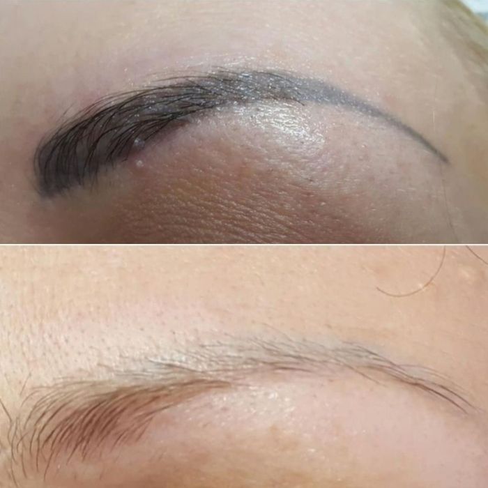 Обучение  лазером  татуаж и тату