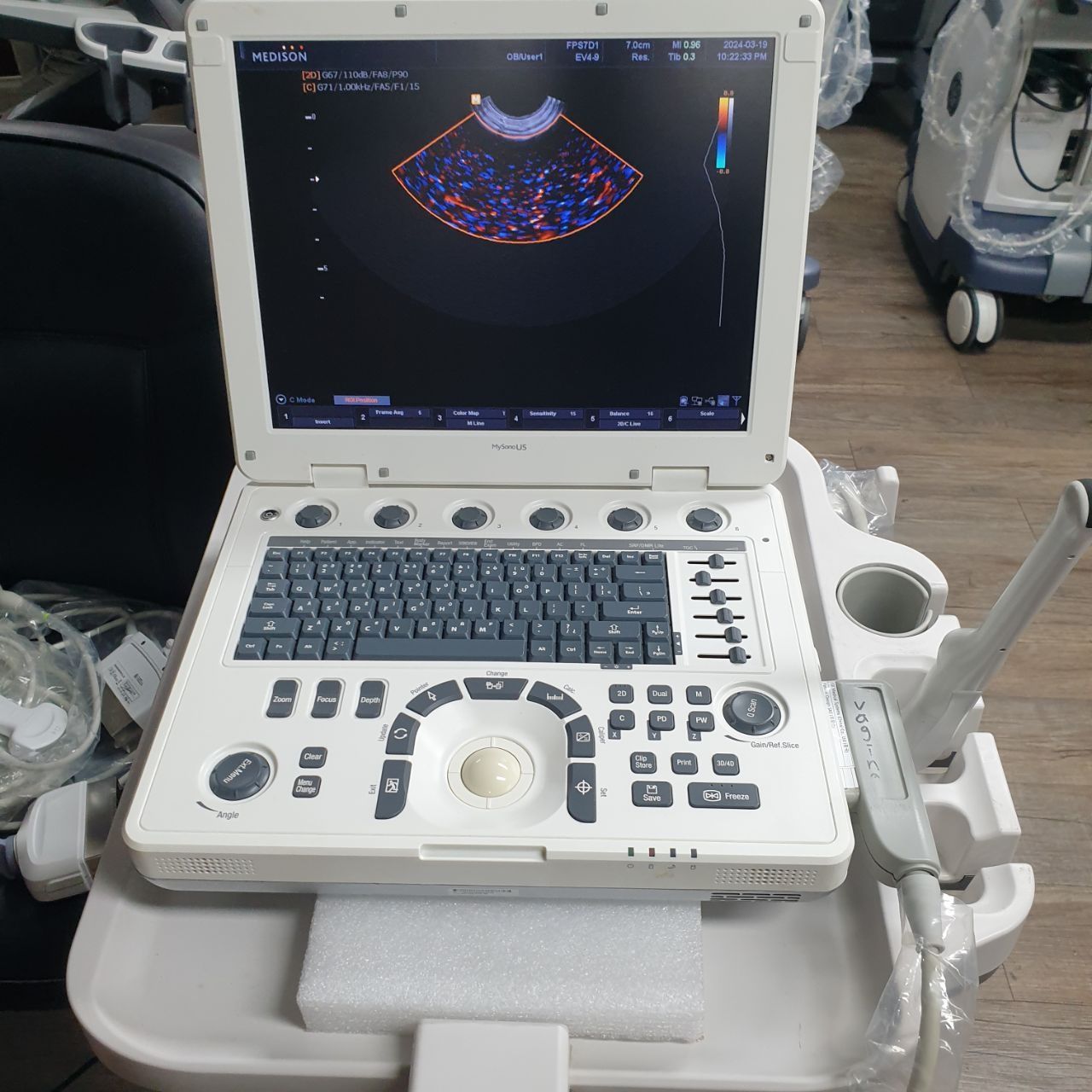 Samsung Medison MySono U5 Portable Ultrasound