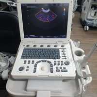 Samsung Medison MySono U5 Portable Ultrasound