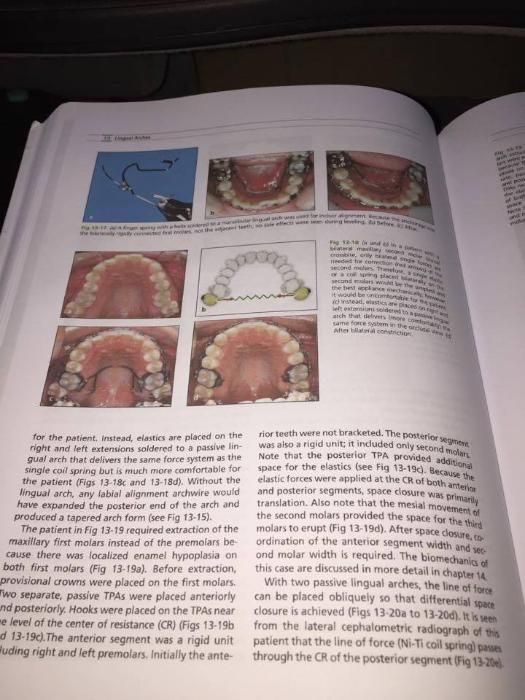 The Biomechanical Foundation of Clinical Orthodontics 2015