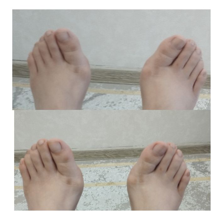 Емдік сауықтыру массажы