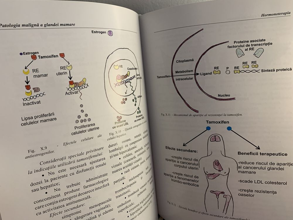 Tratat oncologie Patologia maligna a glandei mamare Prof Bădulescu