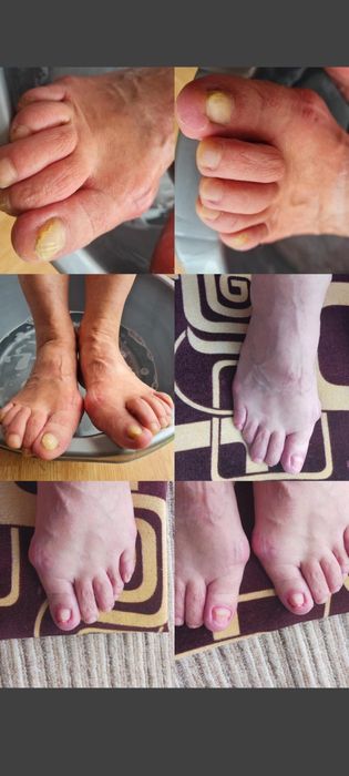 Manichiura și pedichiura profesională podologica la domiciliu