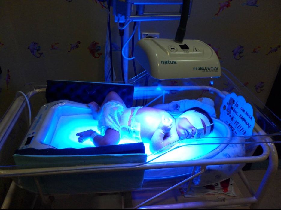 Фотолампа, быстрое восстановление под контролем специалистов