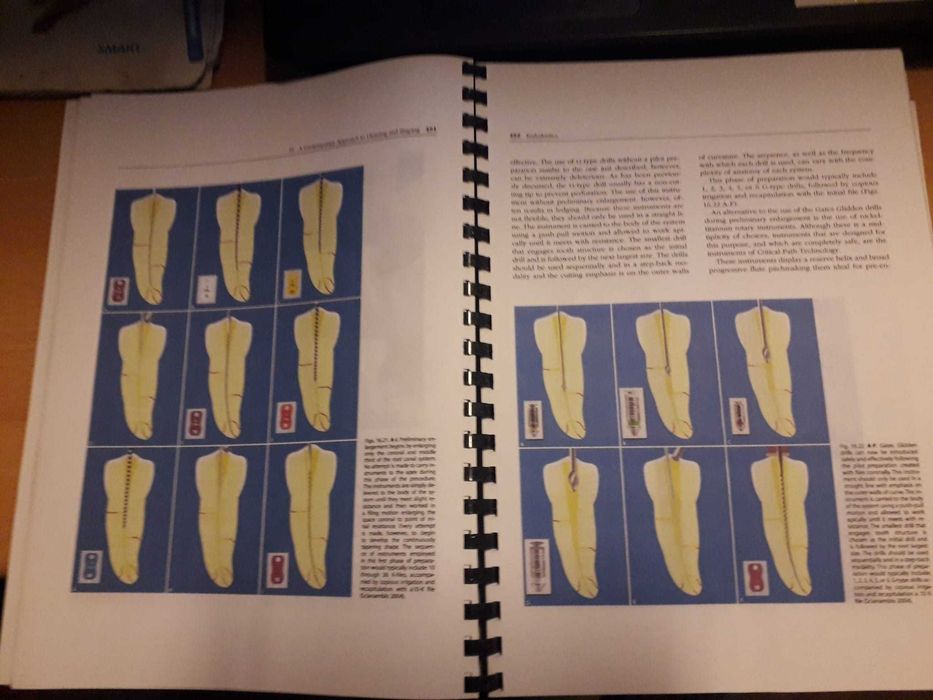 Endodontics- Vol II -stomatologie