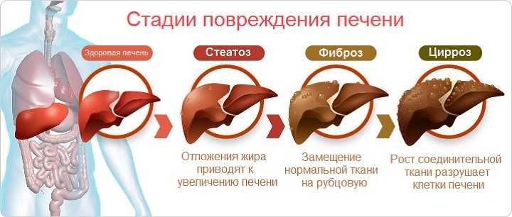 консультации от избавления жира в вашей печени