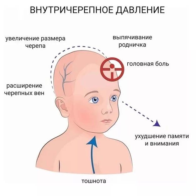 Детский остеопат - невропатолог в Астане