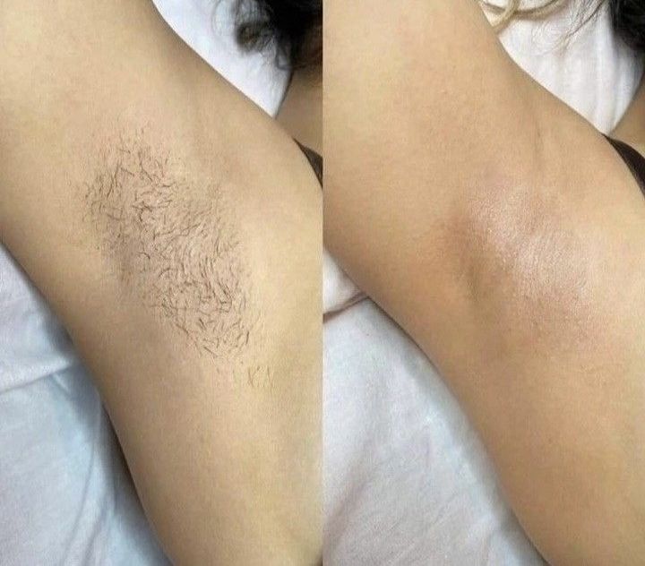 Шугаринг по выгодной цене