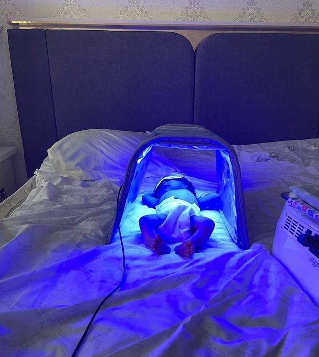 фототерапия дома от желтушки у нов,Фотолампа чакалок сариклигига