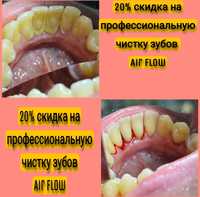 Профессиональная чистка зубов системой Airflow