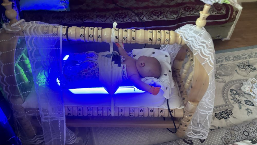 аренда фотолампы от желтушки, фототерапия, лампа люлька, кроватка