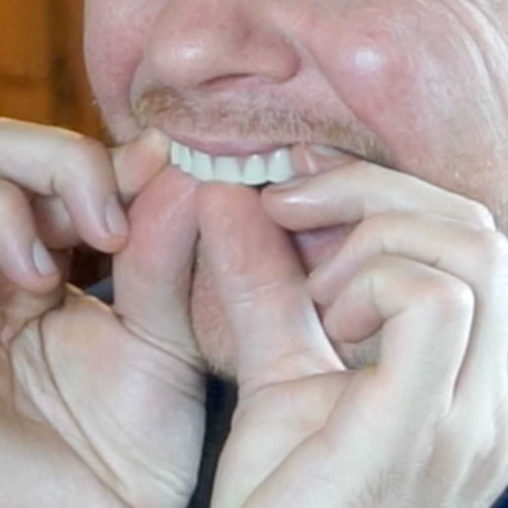 Комплект от горна и долна иновативни протези за зъби Smile