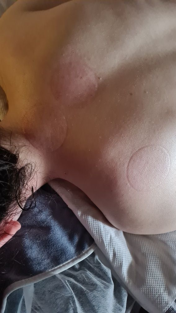 Masaj  Suedez terapeutic , relaxare si  anticelulitic.
