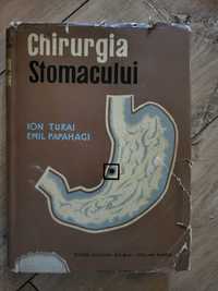 Chirurgia stomacului