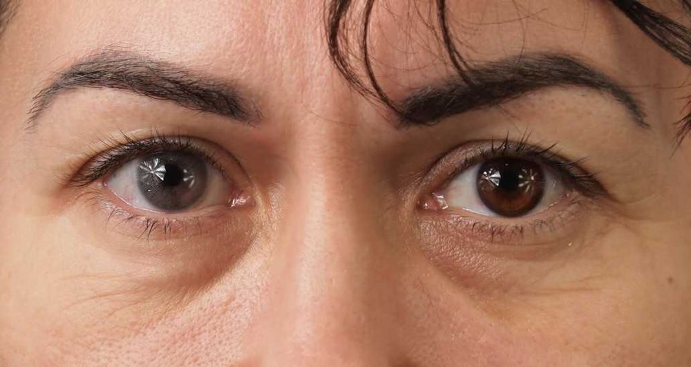 Maldives - lentile de contact colorate anuale, pachet complet