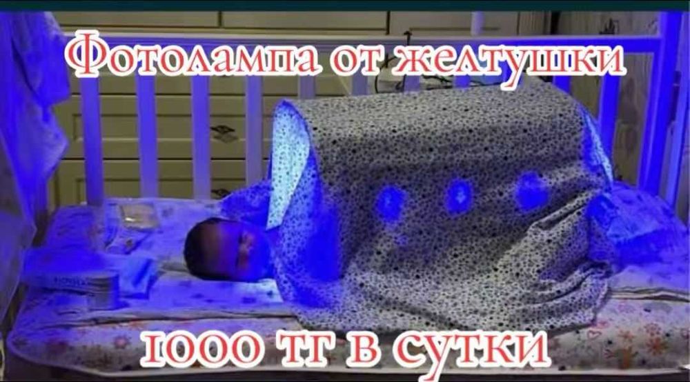 Аренда и прокат лампы фотолампы от желтушки Доставка кювез билирубин